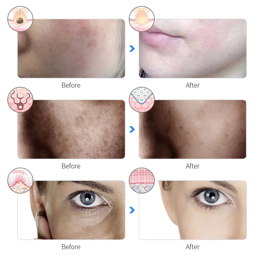 LED Facial Mask – 7 Color Light Therapy for Skin Rejuvenation & Anti-Aging