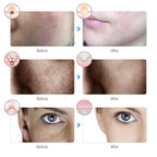 LED Facial Mask – 7 Color Light Therapy for Skin Rejuvenation & Anti-Aging